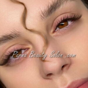 کاشت مژه تهرانپارس